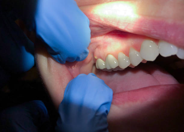 Best Pediatric Emergency Dentist in Cameron, WI