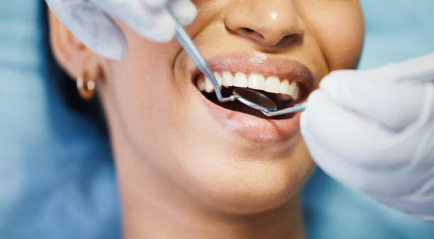 Best Emergency Wisdom Teeth Removal in Cameron, WI